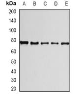 Polyclonal Rabbit anti-Human PRPF3 Antibody (IHC, IF, WB)