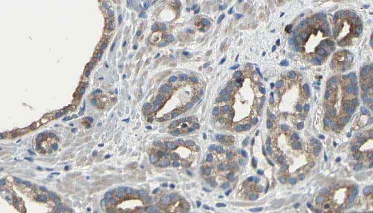 RGS5 Antibody