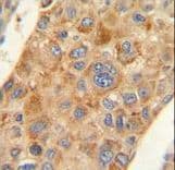 Polyclonal Rabbit anti-Human AMACR / P504S Antibody (aa323-351, IHC, IF, WB)
