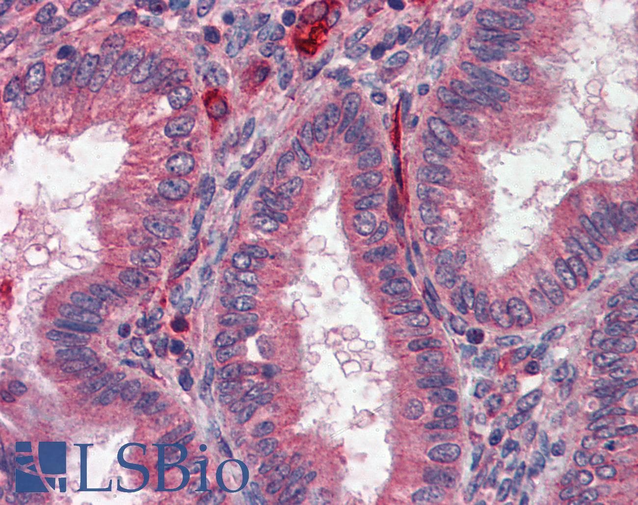 IHC-plus™ ACHE / Acetylcholinesterase Antibody
