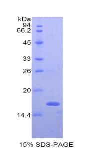 Mouse Beta-N-Acetylglucosaminidase Protein (Recombinant His)