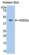 KRT16 / CK16 / Cytokeratin 16 Antibody (aa117-419, Biotin)