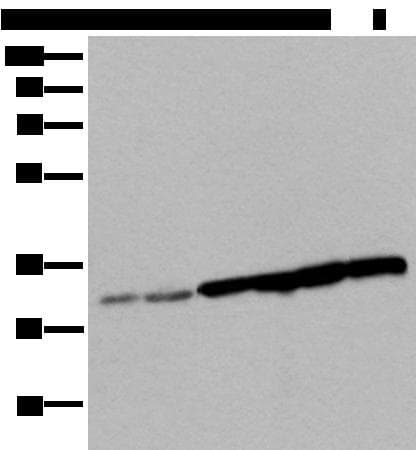 SNRPA / U1A Antibody