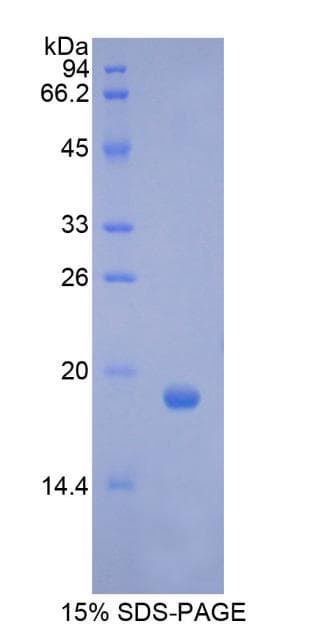 Pig CSF3 / G-CSF Protein (Recombinant His)