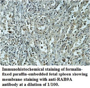 Polyclonal Rabbit anti-Human RAB9A / RAB9 Antibody (aa1-201, IHC)