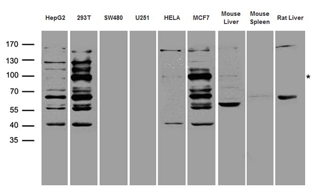Polyclonal Rabbit anti-Human DNMT3B Antibody (WB)