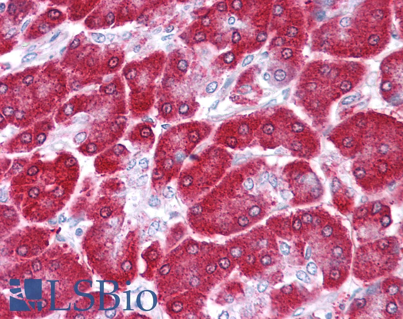 Polyclonal Rabbit anti-Human NME1 / NM23 Antibody (N-Terminus, IHC, WB)