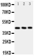 CCR9 / CD199 Antibody (aa1-17)