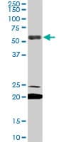 IHC-plus™ Monoclonal Mouse anti-Human EBF3 / COE3 Antibody (clone 8D6, IHC, WB)