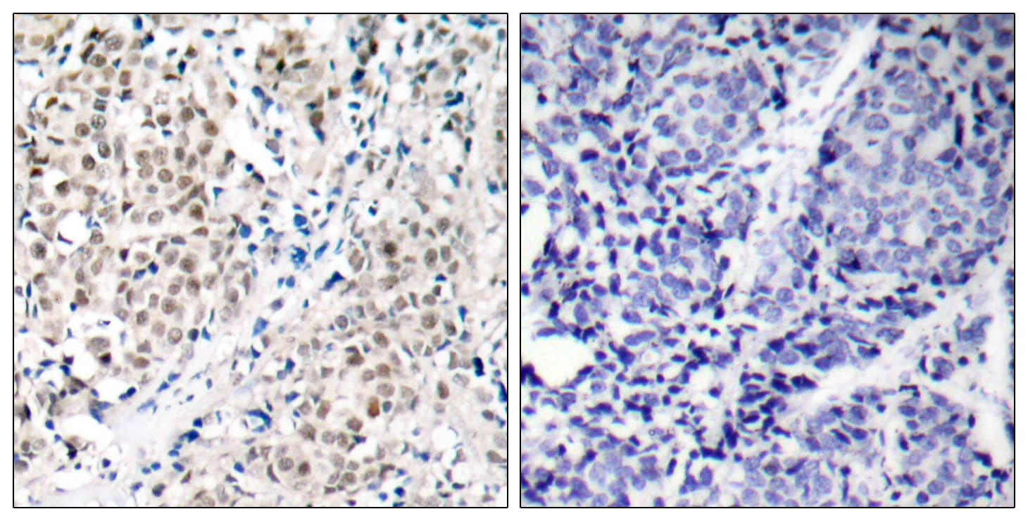 Polyclonal Rabbit anti-Human MYC / c-Myc Antibody (aa325-374, IHC, WB)