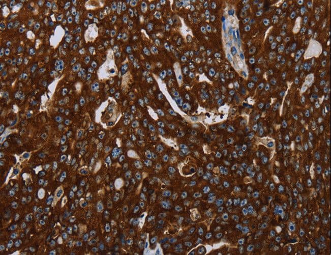 KISS1R / GPR54 Antibody