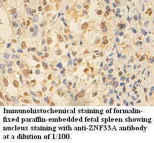 ZNF33A / KOX2 Antibody (aa453-738)