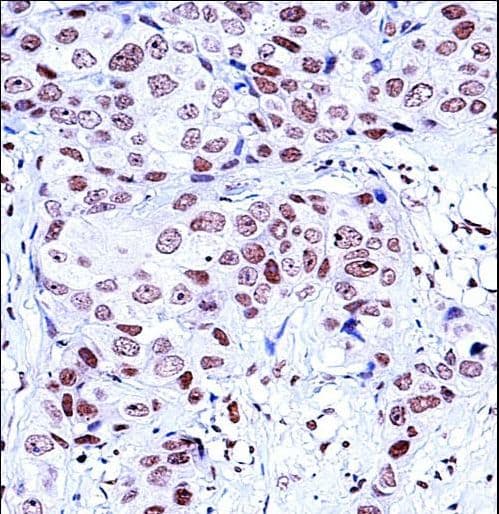 NCK1 / NCK Antibody (aa63-92)