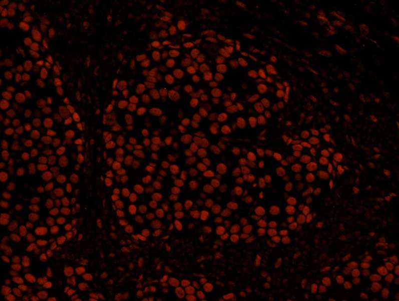 HDAC2 Antibody (aa425-C-term)