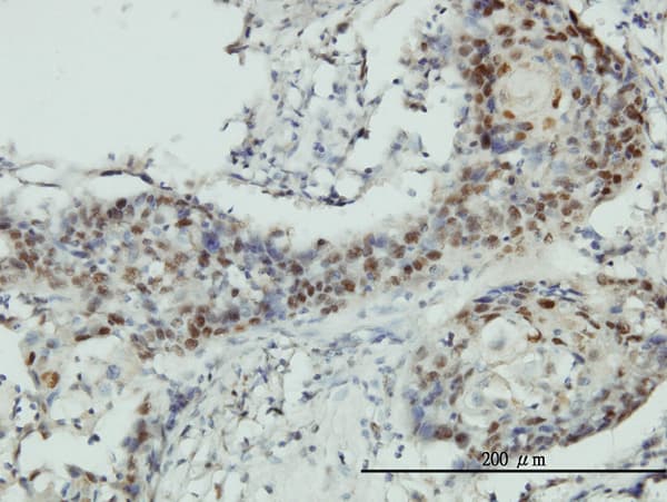 RNMT / HCM Antibody (clone 3H3-1D12)
