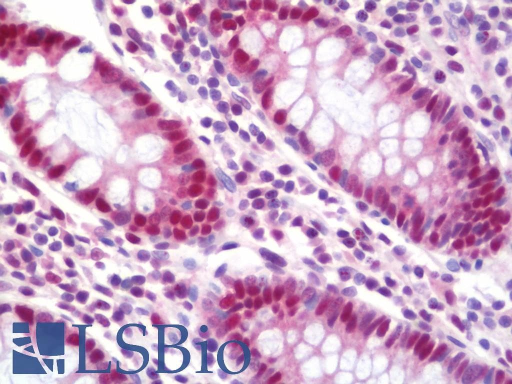 IHC-plus™ PRMT4 / CARM1 Antibody (aa550-C-term)
