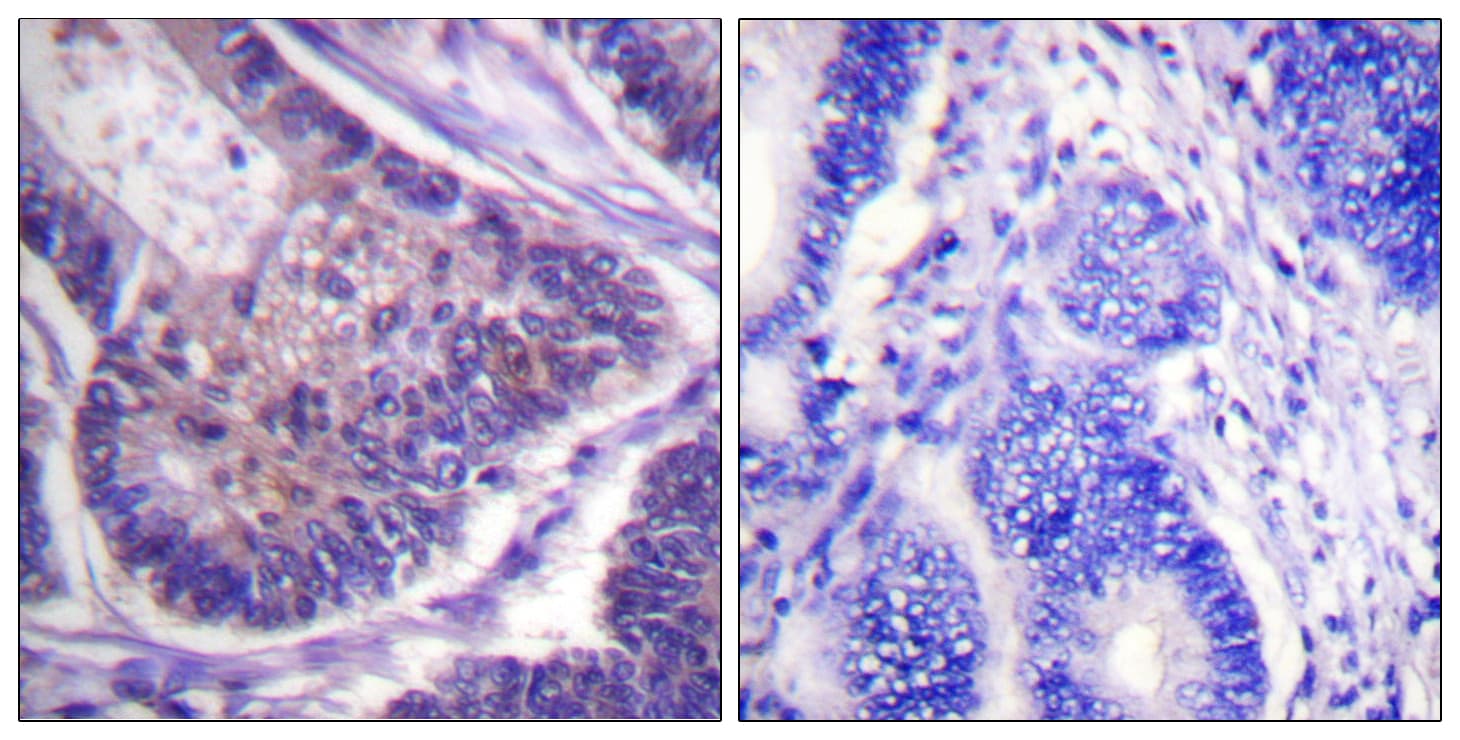 Polyclonal Rabbit anti-Human EIF4B Antibody (aa388-437, IHC, IF, WB)