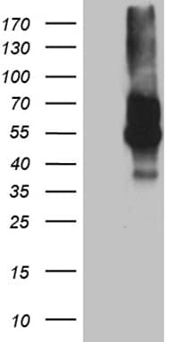 Monoclonal Mouse anti-Human VSIR / GI24 / VISTA Antibody (clone OTI1D10C1, WB)