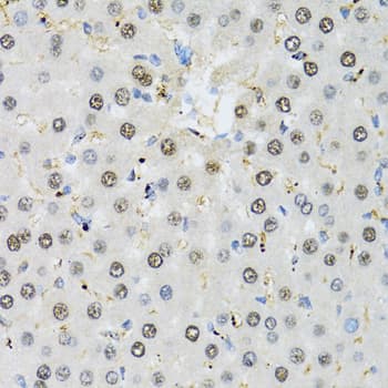 Polyclonal Rabbit anti-Human MAPK10 / JNK3 Antibody (IHC, WB)