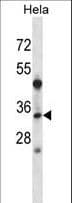 Polyclonal Rabbit anti-Human LAT2 / NTAL Antibody (aa107-135, WB)