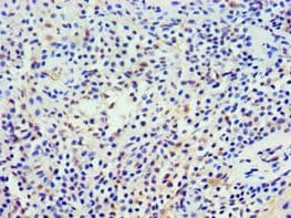 NCS1 / Neuronal Calcium Sensor Antibody (aa1-190)