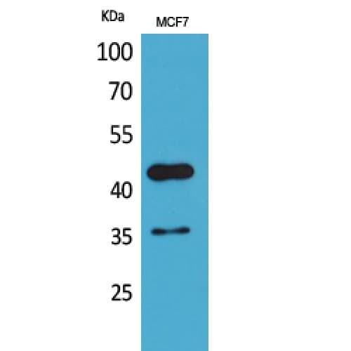 ANGPTL4 Antibody (301-350 aa, Internal)