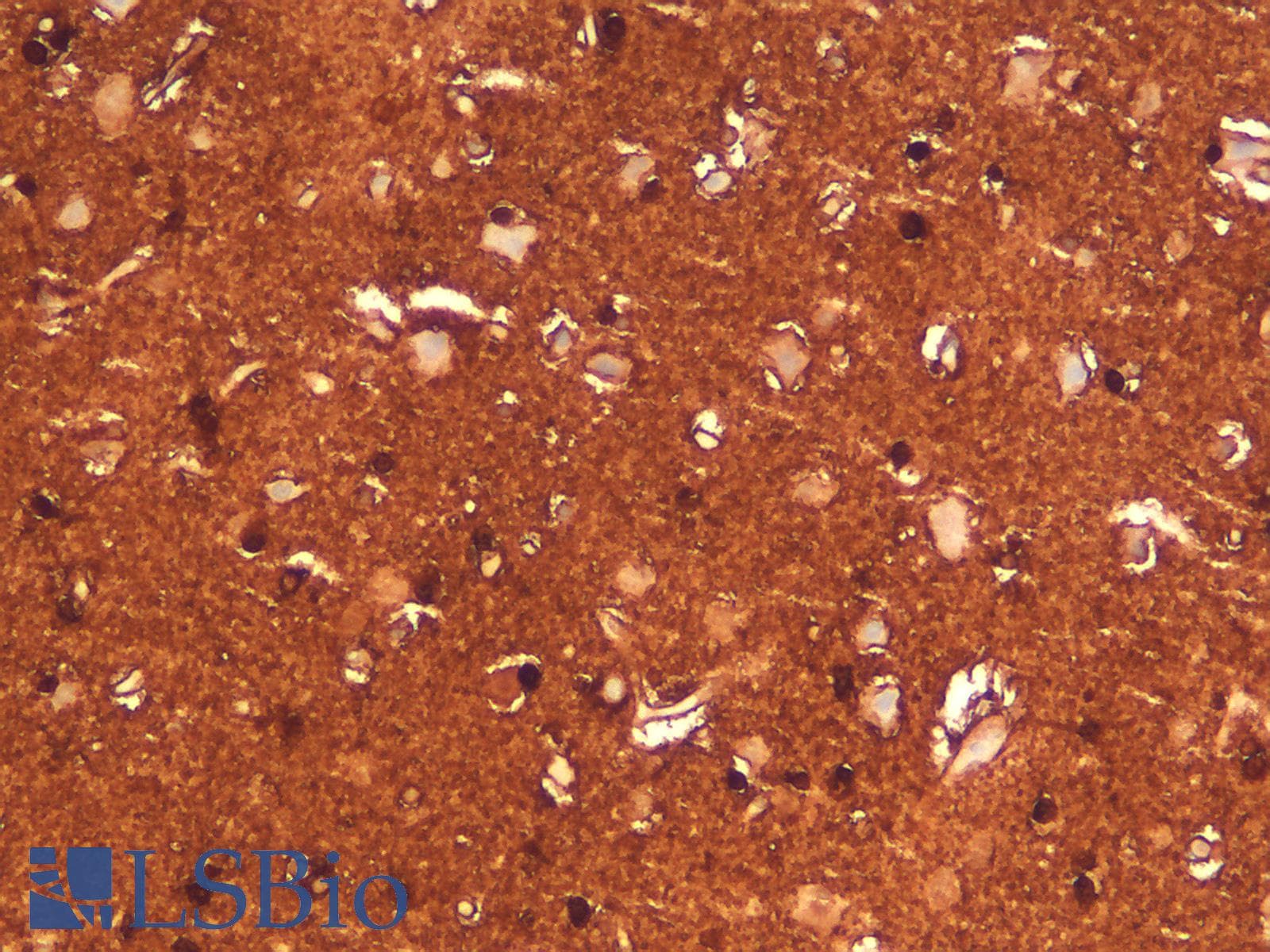 PathPlus™ Recombinant Monoclonal Rabbit anti-Human S100B / S100 Beta Antibody (clone S100B/1706R, IHC)