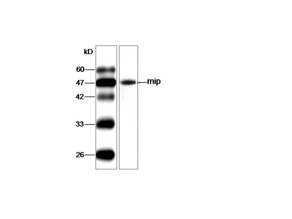 Legionella pneumophila mip Antibody (aa33-206, clone 33)