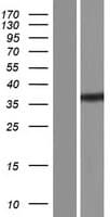 BRMS1 Protein (Over-Expression Lysate Myc-DDK (Flag))