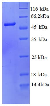 Human SEPSECS Protein (Recombinant His)