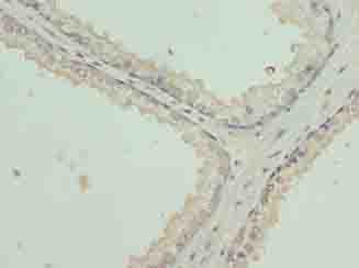 Polyclonal Rabbit anti-Human KRT35 / Keratin 35 / KRTHA5 Antibody (aa1-455, IHC, WB)