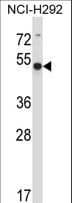 Polyclonal Rabbit anti-Human ACTR6 Antibody (aa346-374, WB)