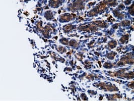 KHK / Ketohexokinase Antibody (clone OTI3D1)