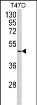 NCF1 / p47phox / p47 phox Antibody (aa 277-303, C-term)