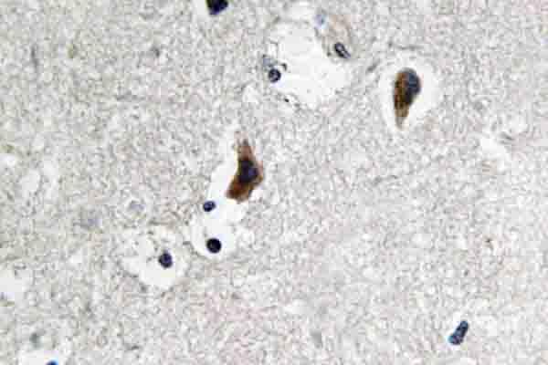 Polyclonal Rabbit anti-Human SRC Antibody (Ser69, IHC, WB)