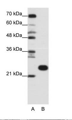 RPL13 / Ribosomal Protein L13 Antibody (C-Terminus, HRP)