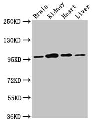 Polyclonal Rabbit anti-Human NARG1 / NAA15 Antibody (WB)