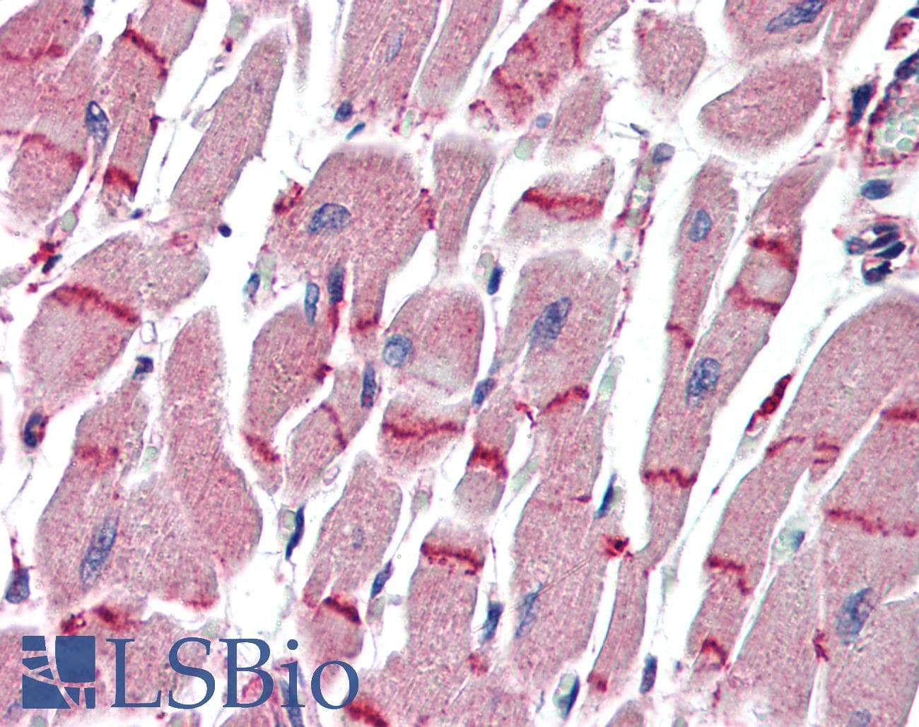 IHC-plus™ APAF1 / APAF-1 Antibody (C-Terminus)