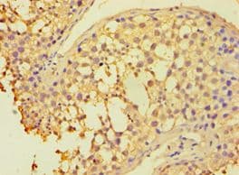 HAUS3 / C4orf15 Antibody (aa384-603)