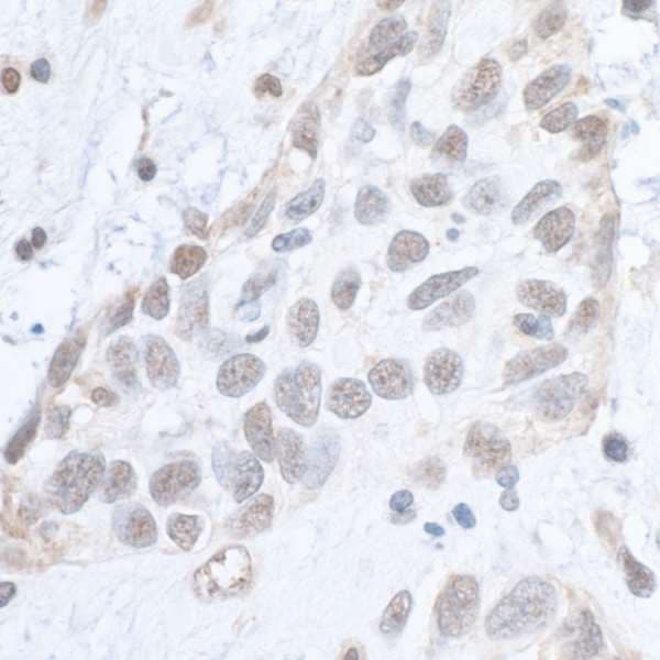 Polyclonal Rabbit anti-Human SMC1A / SMC1 Antibody (phospho-Ser966, IHC, IF, WB)