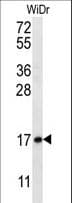 TBCA Antibody (aa15-44)