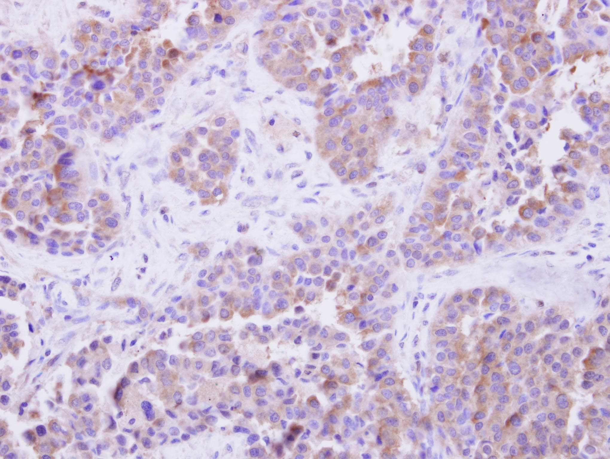 SGTA / SGT Antibody (aa6-313)