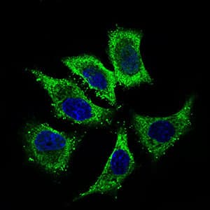 ALDH2 Antibody (aa317-517, clone 4G6A3)