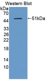 PLB1 Antibody (aa1036-1458, FITC)