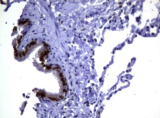 Monoclonal Mouse anti-Human MGMT Antibody (clone UMAB56, Carrier-free, IHC, IF, WB)