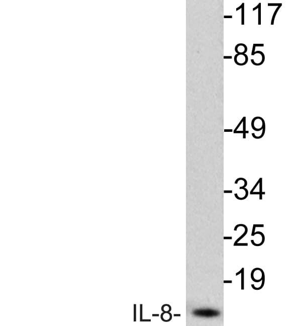 IL8 / Interleukin 8 Antibody (aa19-68)