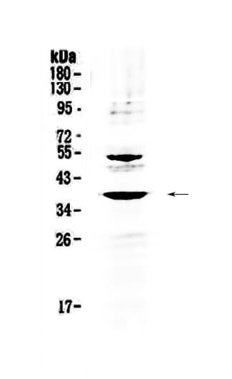 AMD / AMD1 Antibody