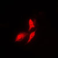 RPS6KB1 / P70S6K / S6K Antibody (C-Terminus)