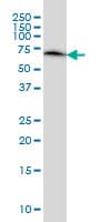 ERO1A / ERO1L Antibody (clone 4G3)