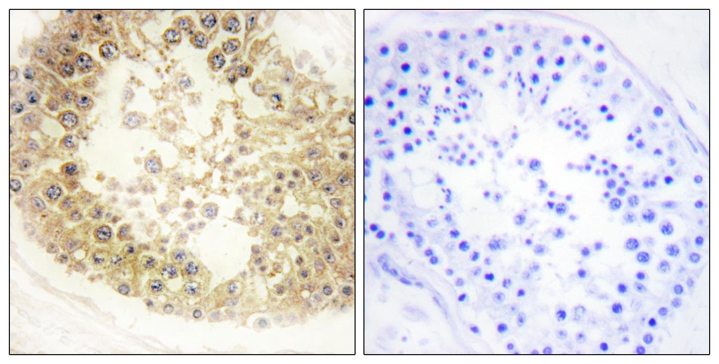 Polyclonal Rabbit anti-Human C2orf40 / ECRG4 Antibody (IHC, IF)